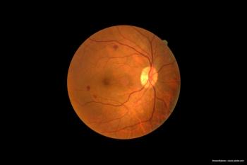 DMO treatment: Brolucizumab proves noninferior to aflibercept, requires fewer injections