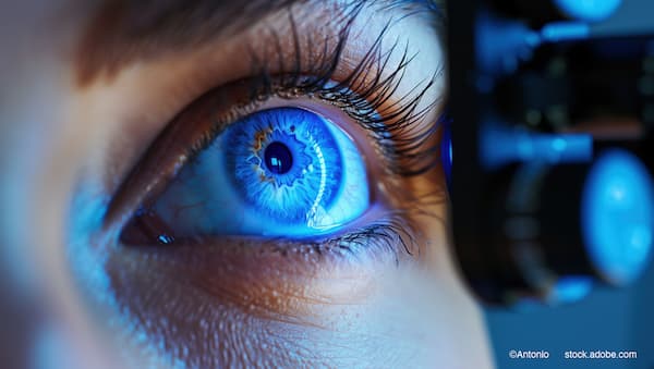 (Image credit: AdobeStock/Antonio) Rethinking SLT: From pressure reduction to biological activation
