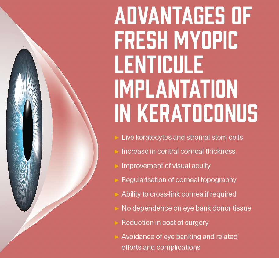 advantages of fresh myopic lenticule implantation