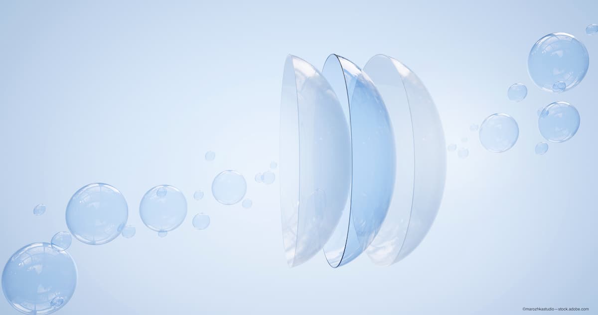 Scleral lens technology and keratoconus: A life-changing option for patients