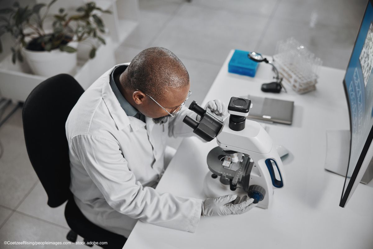 A scientist in a lab looks into a microscope, which is placed on a desk. His face is not fully visible but he wears a lab coat and sits in front of a computer. Concept image for cell therapy, stem cell research, phase 1 clinical trial, and geographic atrophy associated with age-related macular degeneration. Image credit: ©CoetzeeRising/peopleimages.com – stock.adobe.com