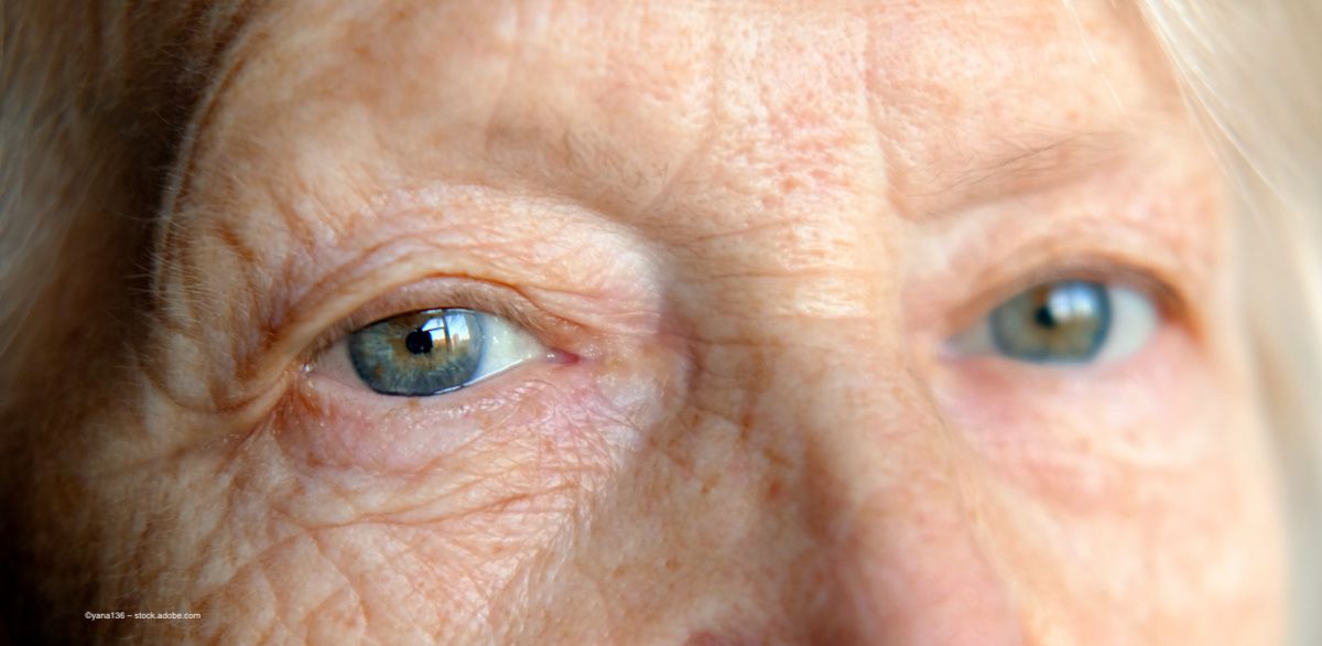A person with wrinkles looks directly at the camera. They have blue eyes. Image credit: ©yana136 – stock.adobe.com
