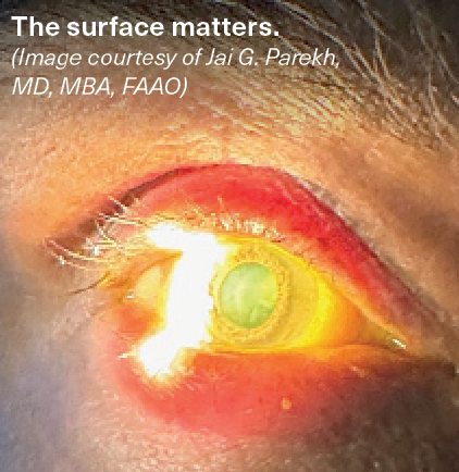 Why paying attention to ocular surface disease preoperatively matters