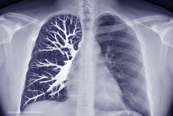 Images of a chest X-ray and a CT scan show the chest and vascular system following a COVID-19 infection. Image credit: ©samunella – stock.adobe.com