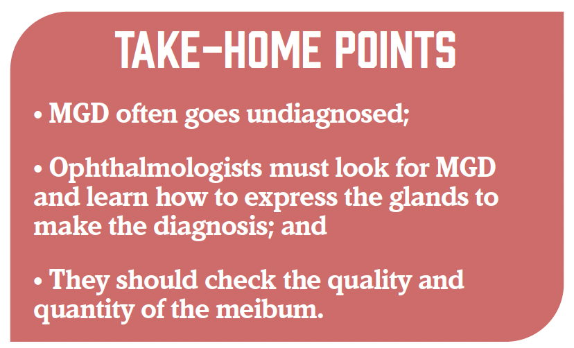 Take home points: MGD often goes undiagnosed; ophthalmologists must look for MGD and learn how to express the glands to make the diagnosis; and they should check the quality and quantity of the meibum.