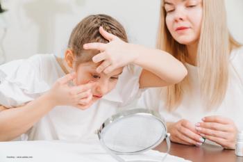 A young boy inserts a contact lens while an adult supervises. ©andrey – stock.adobe.com