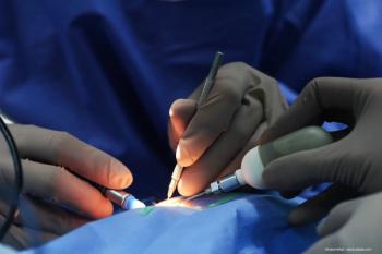 Simplifying cataract surgery in patients with poor mydriasis, compromised zonules