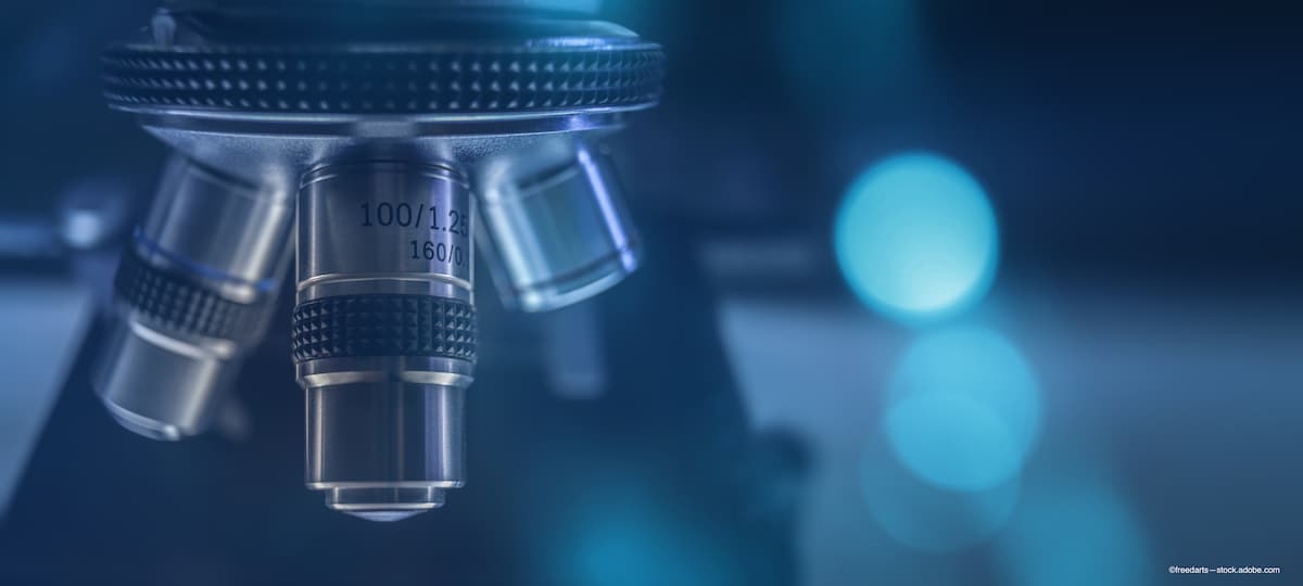 Genetic testing for keratoconus facilitates earlier recognition of condition