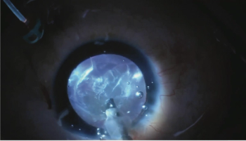 A chandelier is directed horizontally toward the lens.