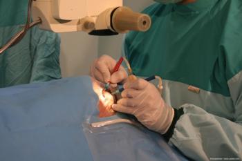 Phaco power modulation boosts safety, efficacy in cataract surgery