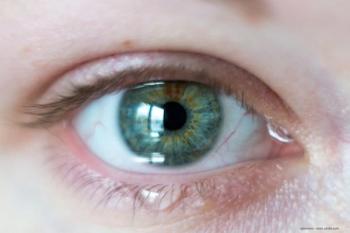 Dextenza approval in US provides new allergic conjunctivitis option