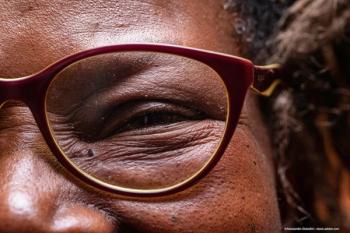 PDS: A new era in the treatment of wet AMD