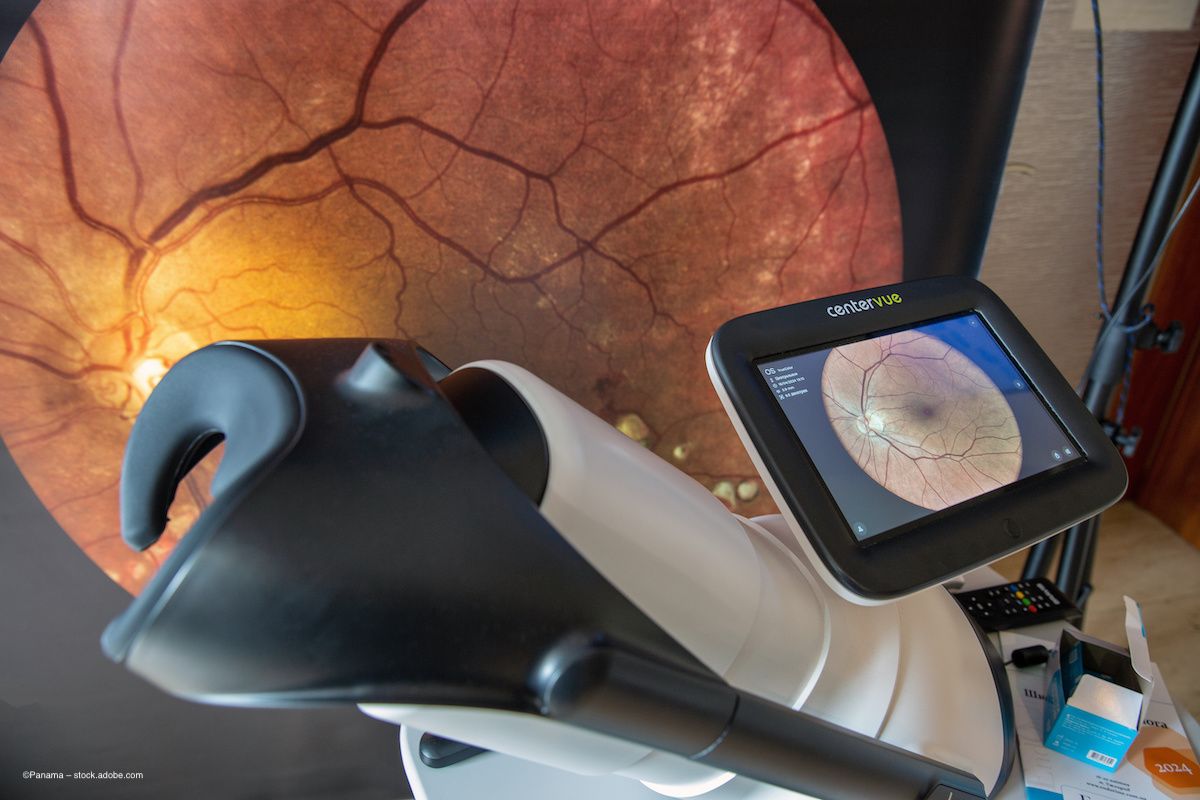 The retina undergoing fundus imaging. Concept image for retinal imgaging, OCT, CA, cardiac angiography, optical coherence tomography and biomarkers. Image credit: ©Panama – stock.adobe.com