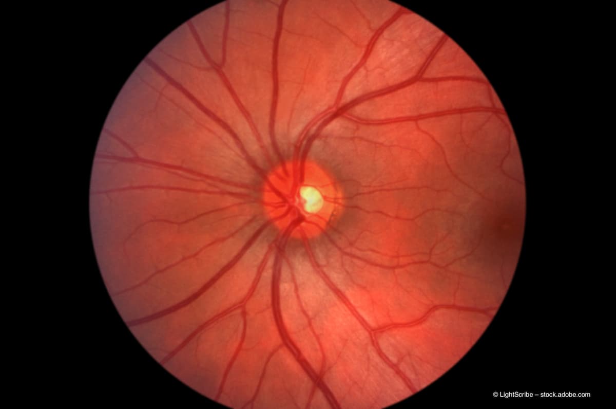 <![CDATA[Orbital and retinal microvascular changes in thyroid eye disease]]>