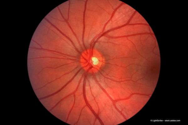 Orbital and retinal microvascular changes in thyroid eye disease