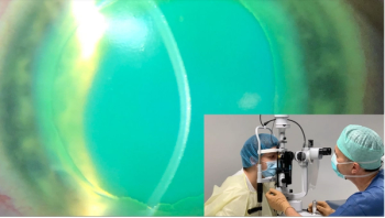 The pathophysiology and pathomorphology of corneal ectasia: Developments in corneal cross-linking therapy broaden its applications