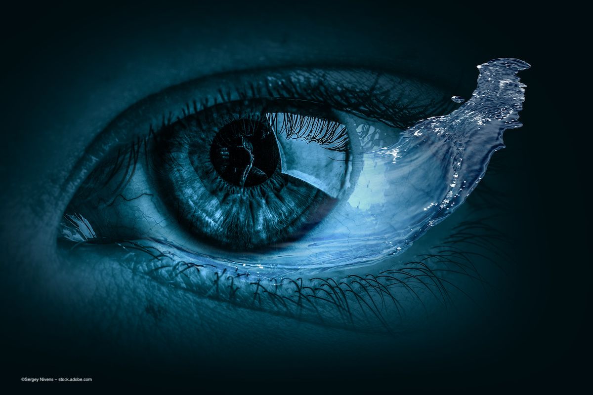A blue eye with a large splash of blue liquid coming out of it. Vitreoretinal surgery ILM dye stain concept. Image credit: ©Sergey Nivens – stock.adobe.com