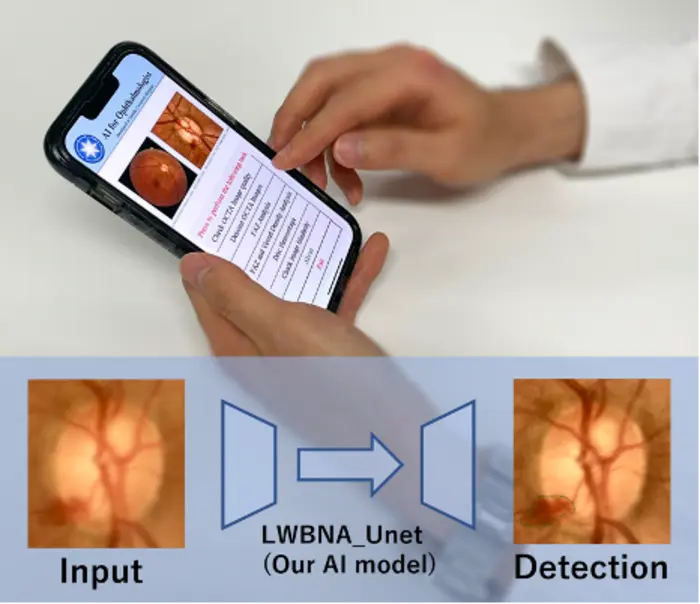 AI for the eye. The developed lightweight model precisely and rapidly detects image abnormalities related to diseases of the eye. The model is expected to provide accurate analysis on mobile devices/low CPU-GPU resource single board computers used in standalone self-monitoring devices. (Image courtesy of Dr Parmanand Sharma)