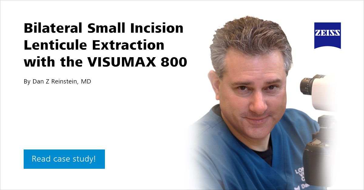 Bilateral Small Incision Lenticule Extraction with SMILE pro using the ...