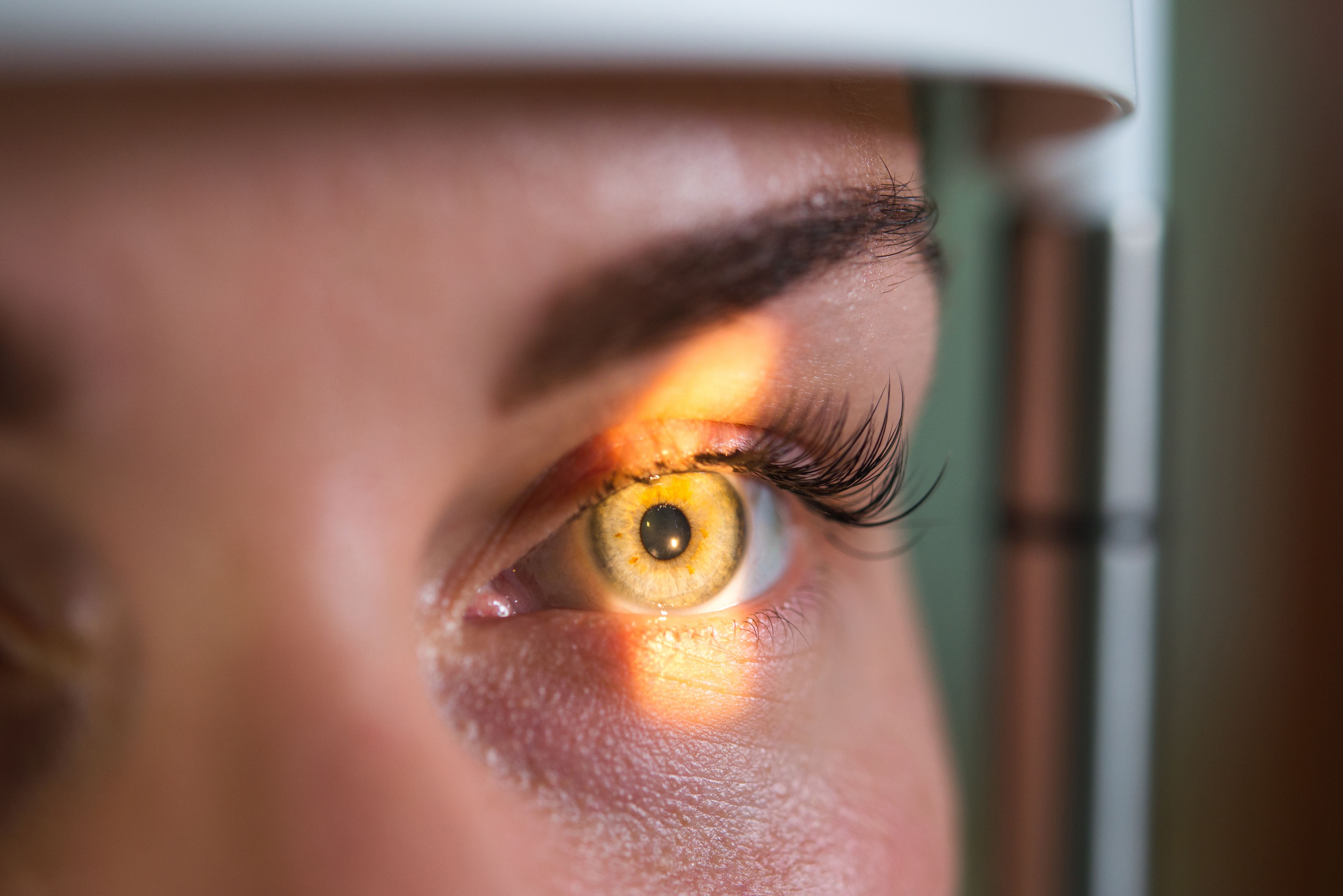 eye exam