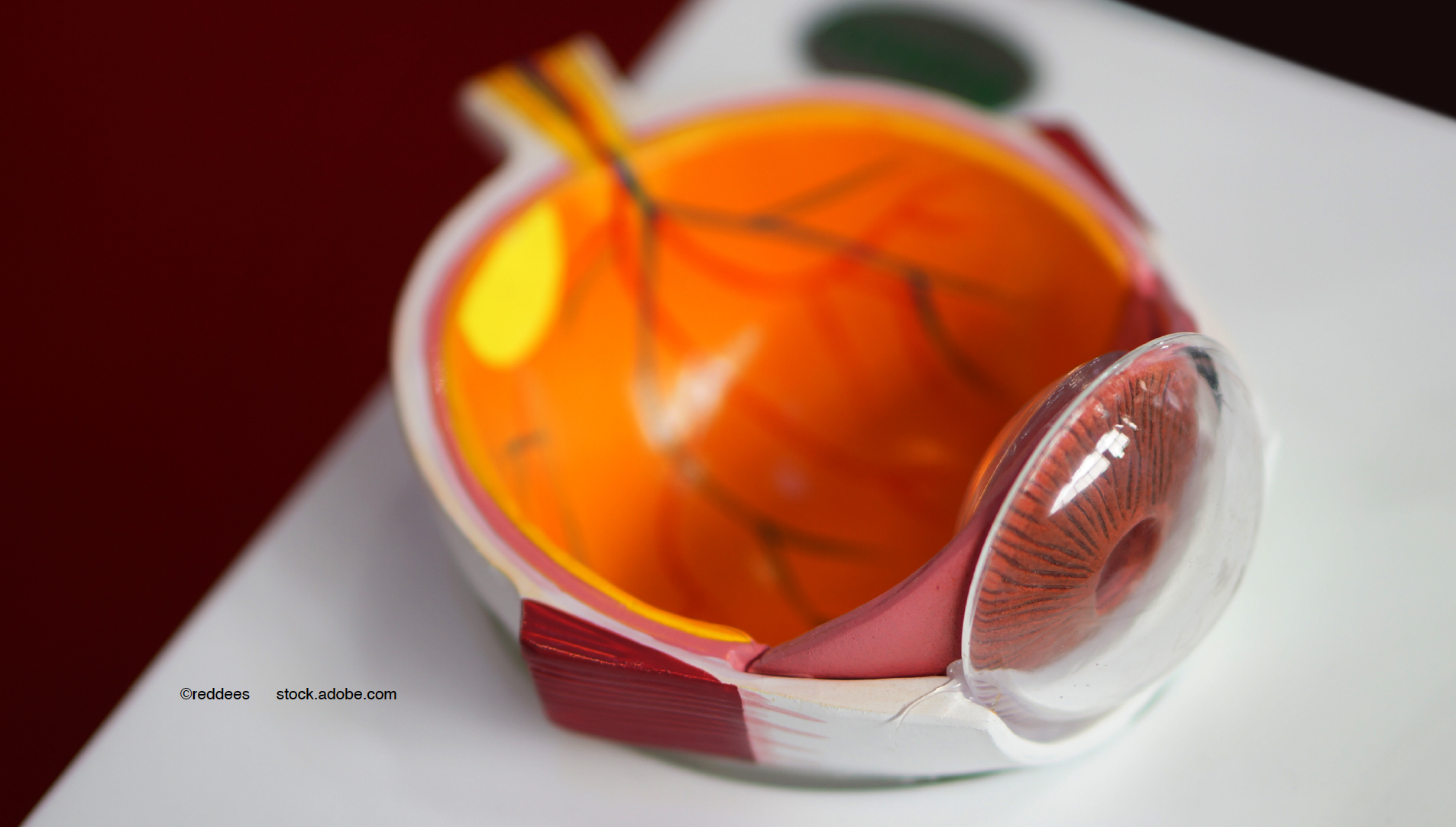 Faricimab for DME: Safe, durable treatment over the long term