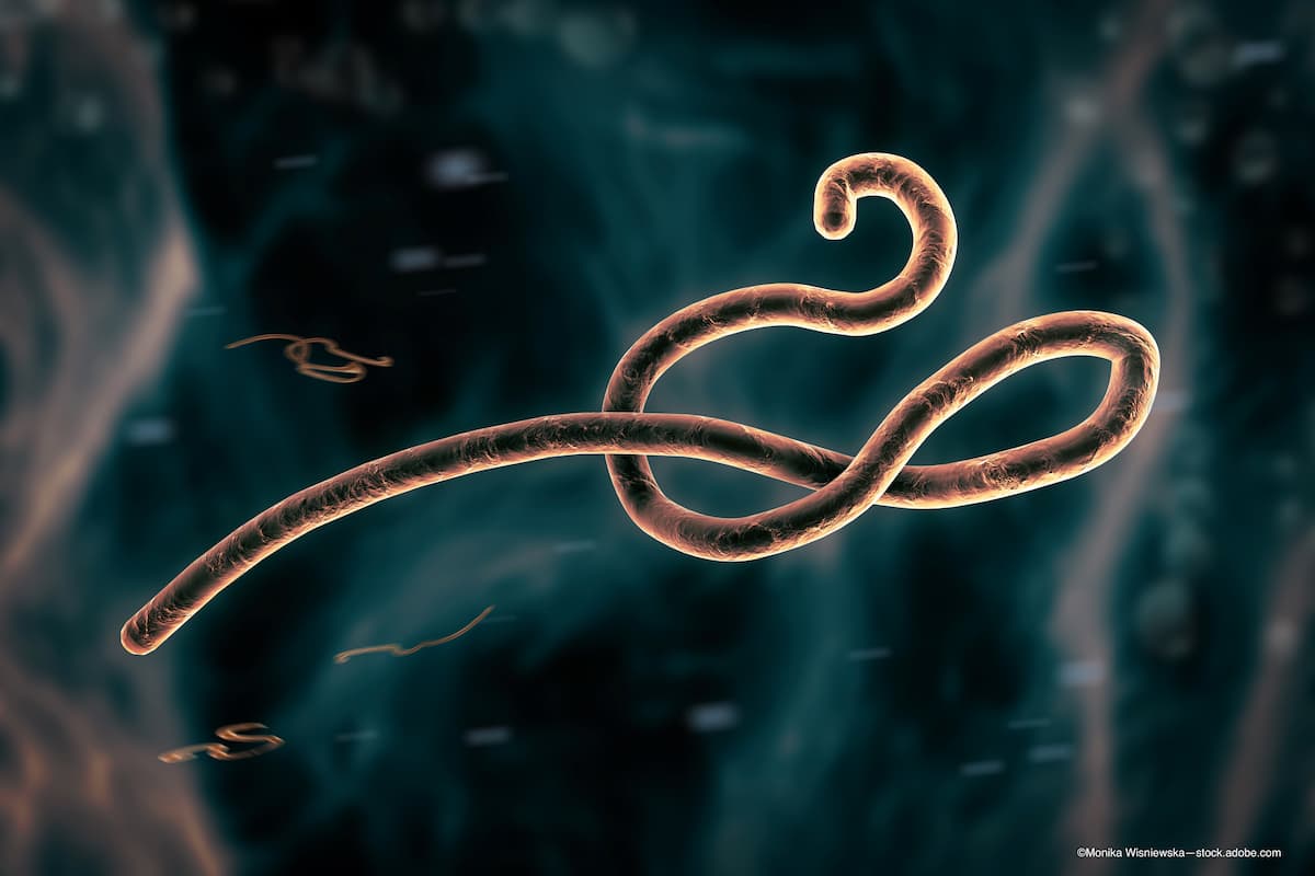 Ebola, other viruses may be housed in retina cells