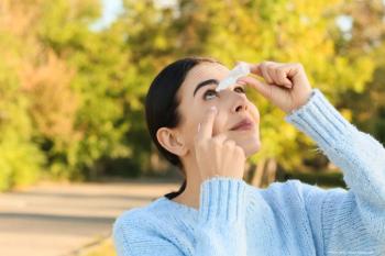 Short-term corticosteroid use can provide rapid relief of allergy symptoms in dry eye disease