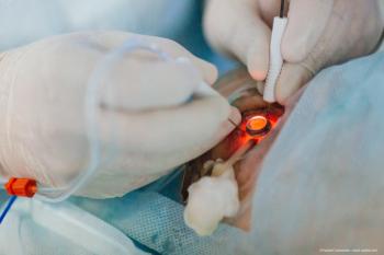 Risk factors for developing rhegmatogenous retinal detachments in fellow eyes identified in study