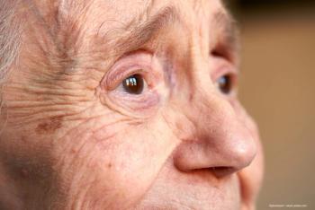 Bimatoprost implant reduces intraocular pressure for 2 years or more