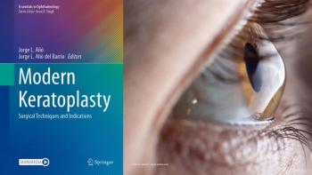 The cover of "Modern Keratoplasty: Surgical Techniques and Indications" next to an image of an eye. Book cover image used with permission from Springer Nature. Cornea image credit: ©Zarina Lukash – stock.adobe.com