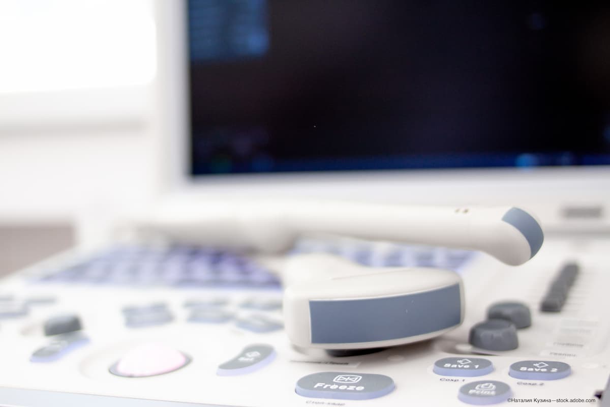 Noninvasive retinal stimulation achieved via ultrasound