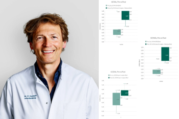 Frank Kerkhoff, MD, PhD, and visual acuity charts following implantation with the Johnson and Johnson Tecnis Odyssey lens.