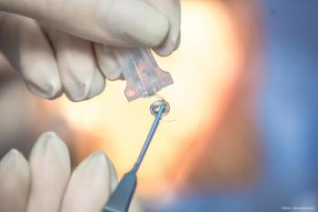Johnson + Johnson's TECNIS Eyhance Toric II IOL launches in Europe