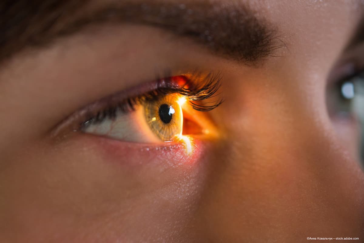 Optogenetic therapy for retinal degeneration shows potential of gene-independent therapeutic strategies 