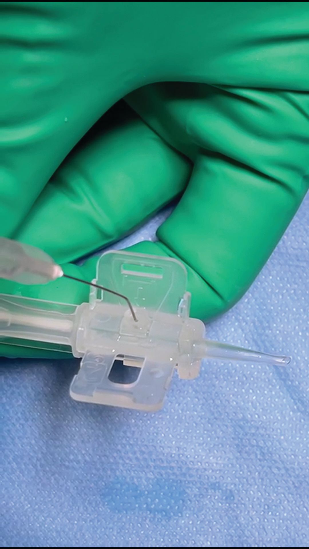 New IOL offers patients greater spectacle independence over wider range