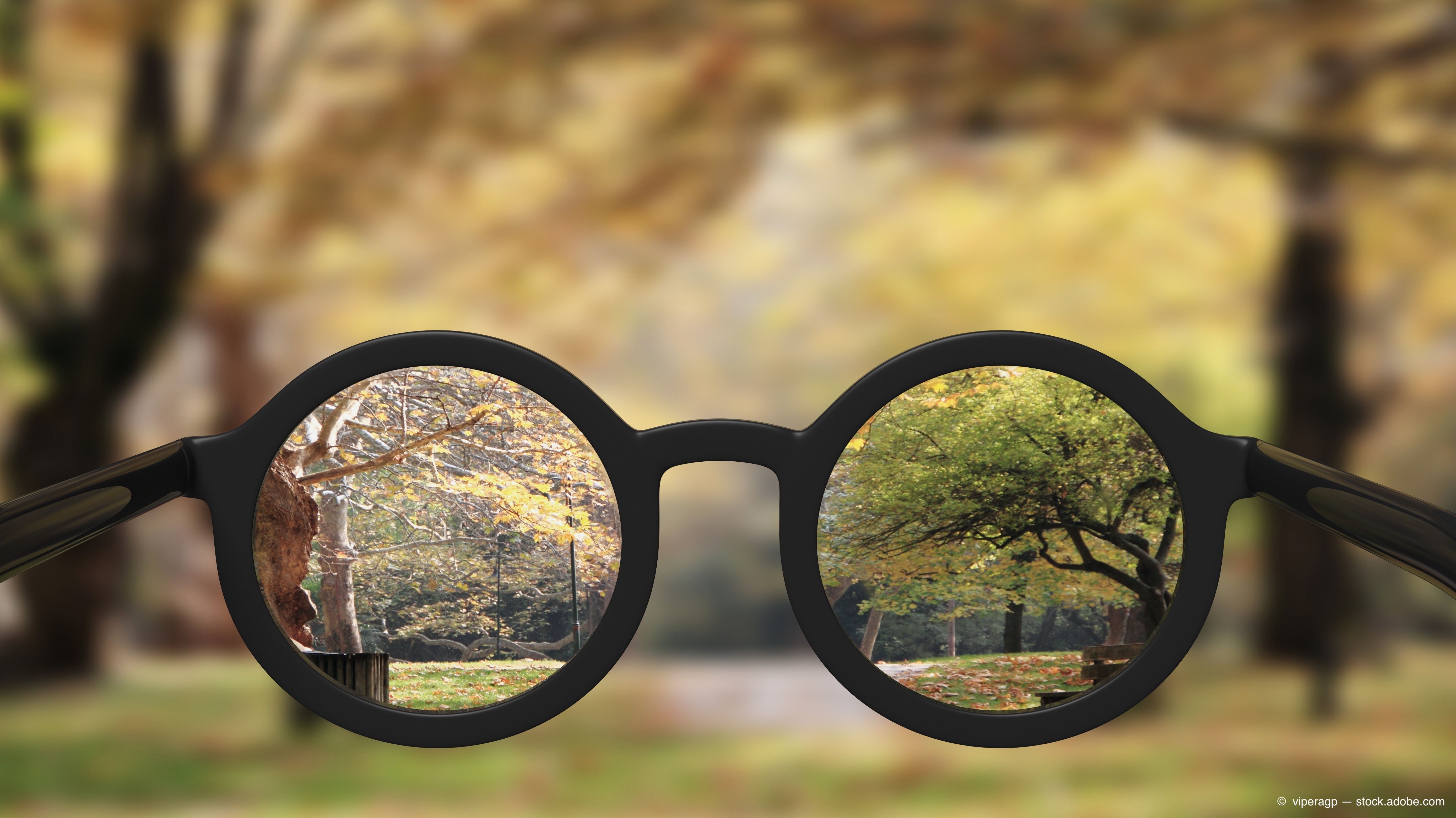 Очко картинки. Вид через очки. Взгляд через очки. Очки для близорукости. Мир в очках.
