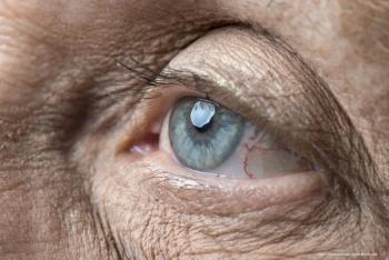 Intravitreal pegcetacoplan proves useful for geographic atrophy: Phase 3 results of OAKS and DERBY studies