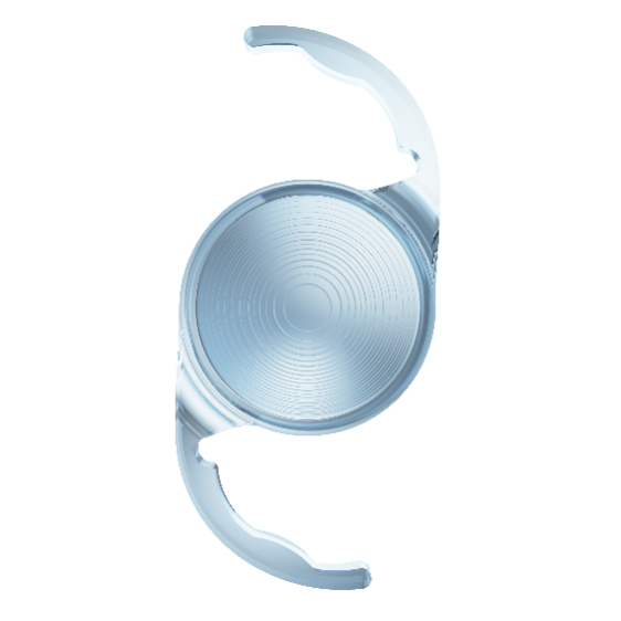 Onboarding a new trifocal hydrophobic C-loop IOL My early experiences ...