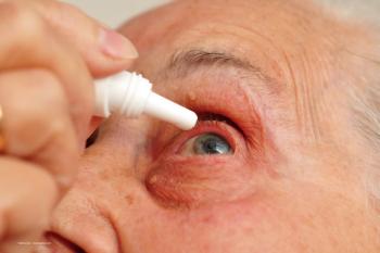 A close-up of an elderly patient's face. They are administering eye drops. Image credit: ©photocrew – stock.adobe.com