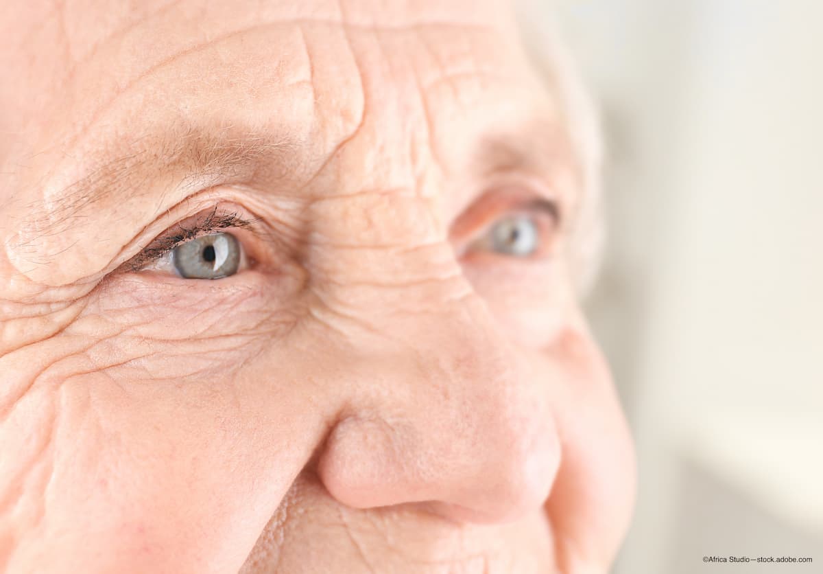 Home monitoring of wet AMD offers high-quality scans