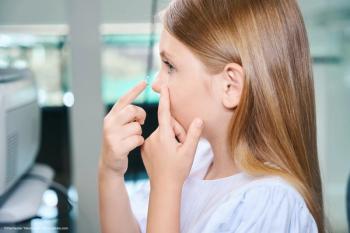 A girl inserts a contact lens. Image credit: ©Viacheslav Yakobchuk – stock.adobe.com