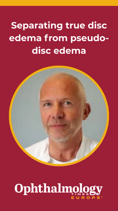 Separating true disc edema from pseudo-disc edema