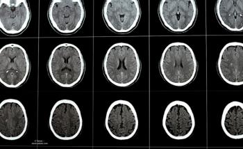 A series of images of brain scans. Image credit: © Tamer – stock.adobe.com