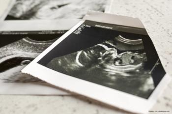 Diabetes during pregnancy linked to high refractive error in offspring