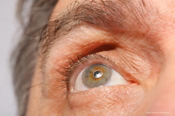 A simple solution for complex corneas
