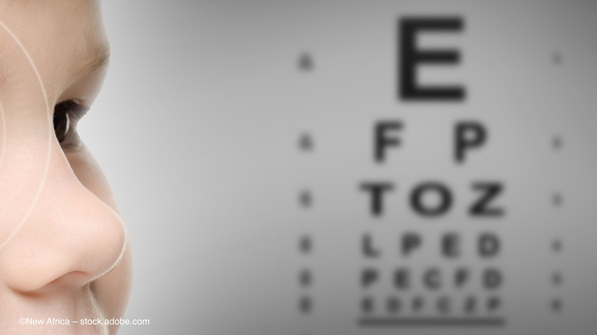 A child's face, in profile, next to a Snellen chart. Concept image for atropine use in paediatric patients with myopia and long-term effects or complications of atropine and red light therapy. Image credit: ©New Africa – stock.adobe.com
