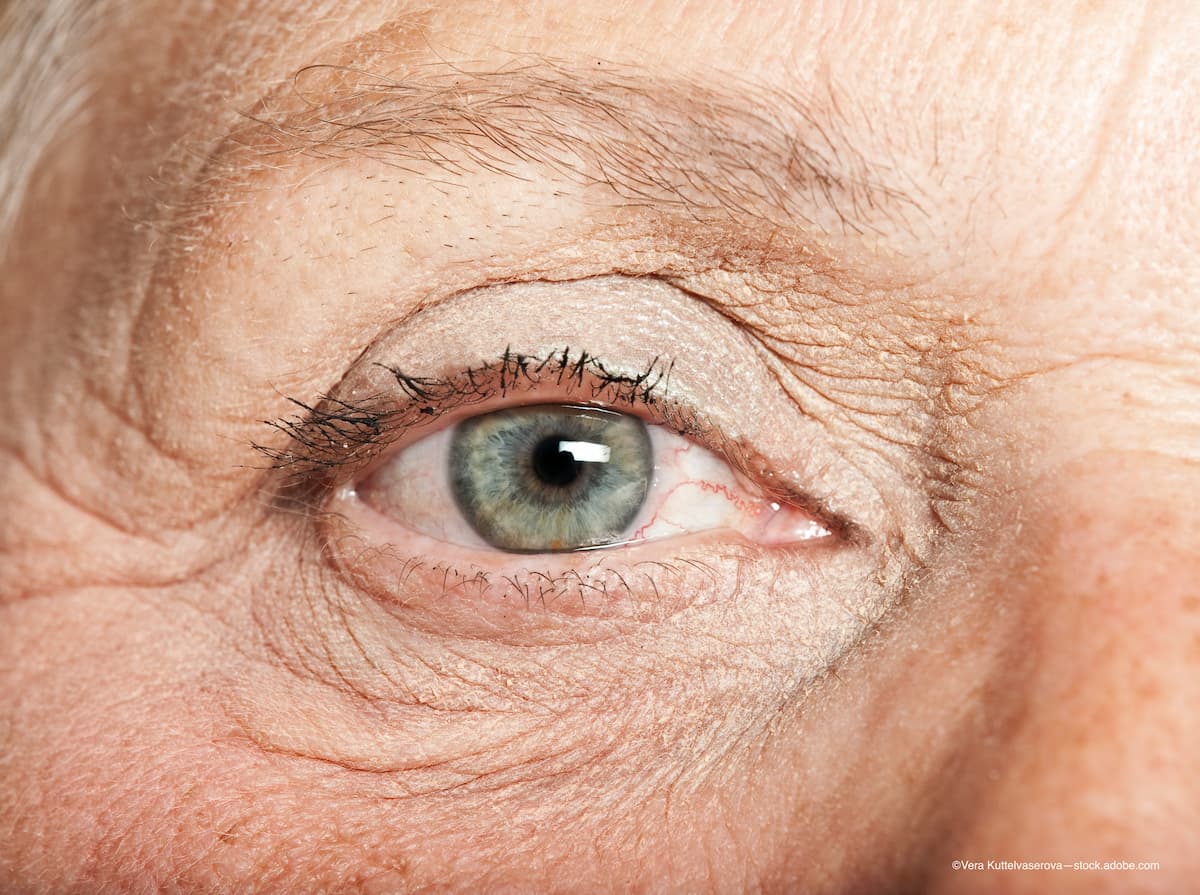 Injectable axitnib intravitreal implant delivers high drug levels to retinal tissue