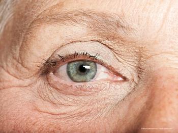 Injectable axitnib intravitreal implant delivers high drug levels to retinal tissue