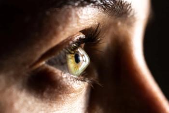 Closeup of keratoconic eye Image credit: AdobeStock/AlessandroGrandini