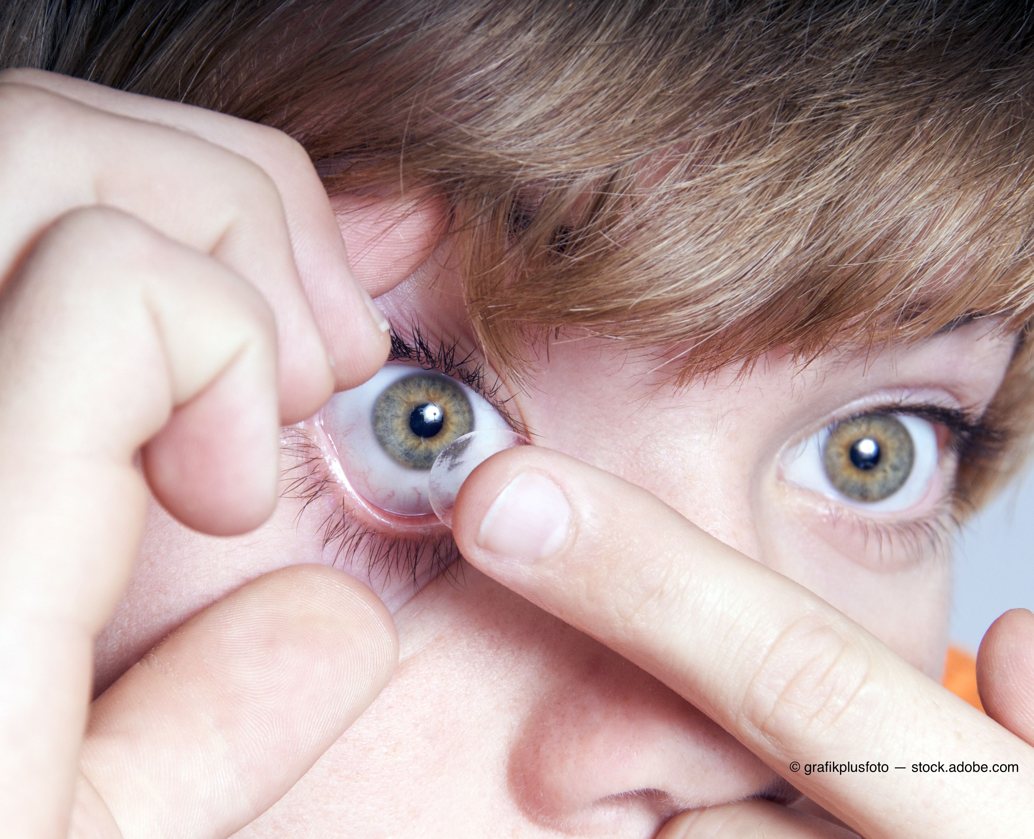 Коррекция зрения с помощью линз. Линзы для глаз. Контактные линзы для детей. Контактные линзы для зрения. Контактные линзы подросток.